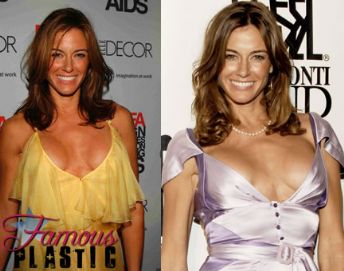 Kelly Bensimon Boob Job 5oceanos