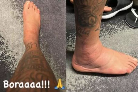 Neymar shows the worrying state of his ankle on social media