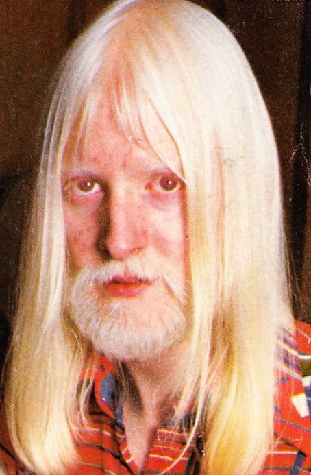 Edgar Winter Pics - Edgar Winter Photo Gallery - 2018 - Edgar Winter ...